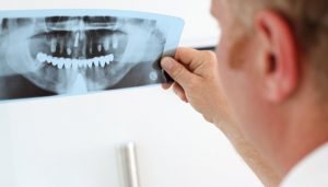 cirugia-maxilofacial